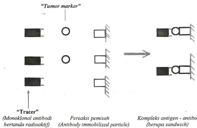 Gambar 2. Prinsip reaksi immunologi pada IRMA dalam penentuan &#34;tumor marker&#34; (4,5).