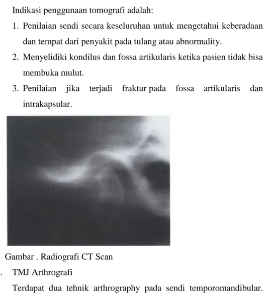 Gambar . Radiografi CT Scan  e.  TMJ Arthrografi 