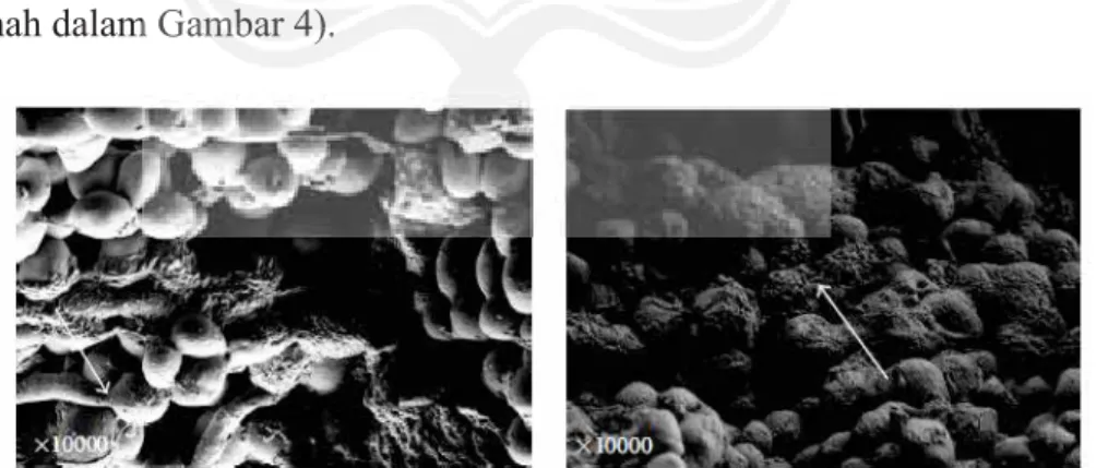 Gambar 4.  SEM dari Candida albicans dengan konsentrasi 10 6 mL -1  pada hari  ke-1 (kiri) blastokonidium belum terlapisi biofilm  dan hari ke-5 (kanan) blastokonidium terlapisi biofilm ( Sumber: Pasteur dkk.,  2011)  
