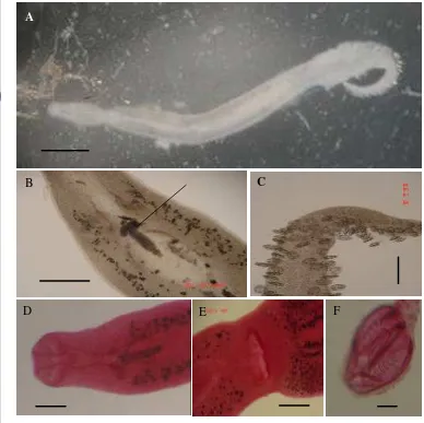 Gambar 9. Gotocotyla secunda (Tripathi, 1956) yang ditemukan pada insang ikan 