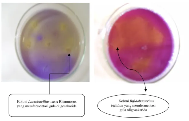 Gambar 1. Bakteri L.casei  Rhamnosus dan B.bifidum yang memfermentasi gula oligosakarida ekstrak  tepung buah rumbia 