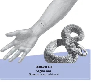 Gambar 9.8Gigitan ular 