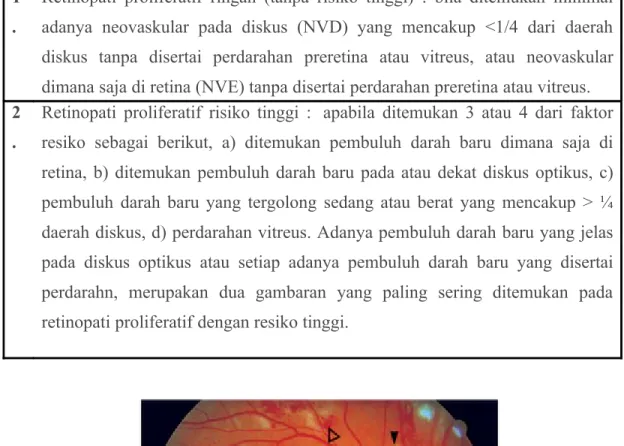 Gambar 4 : Funduskopi pada NPDR. Mikroneurisma, hemorrhages intraretina (kepala panah  terbuka), hard exudates merupakan deposit lipid pada retina (panah), cotton-wool spots  menandakan infark serabut saraf dan eksudat halus (kepala panah hitam)