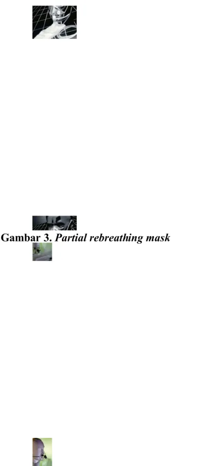 Gambar 3. Partial rebreathing mask 