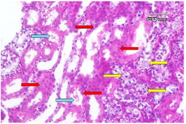 Gambar  8.  Gambaran mikroskopik ginjal tikus  wistar Kelompok IV (perlakuan injeksi  gentamisin selama 7 hari dilanjutkan dengan  pemberian pelet selama 7 hari)