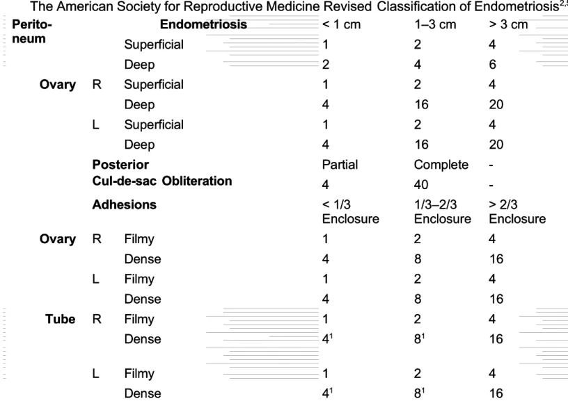 Tabel 1. American Society for Reproductive Medicine Revised Classification of Endometriosis