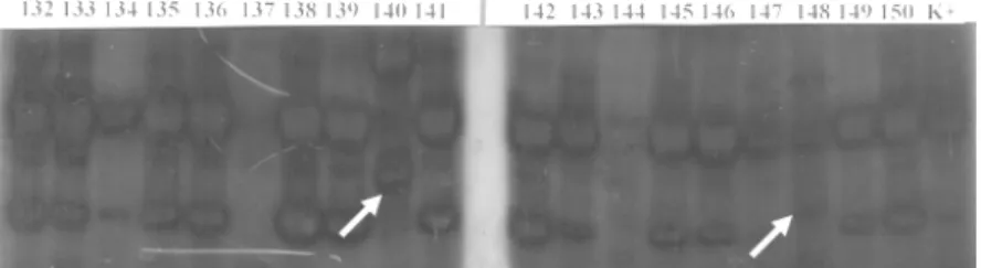 Gambar 2.  Hasil amplifikasi DNA M. tuberculosis dengan menggunakan PCR untuk  gen pncA primer P1P2