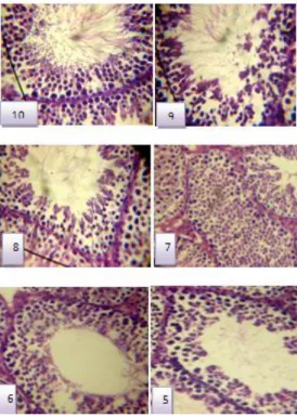 Gambar 5.  Penampang tubulus seminiferus mencit jantan yang dipontong melintang untuk   penilaian klasifikasi spermatogenesis sesuai skor Johnson