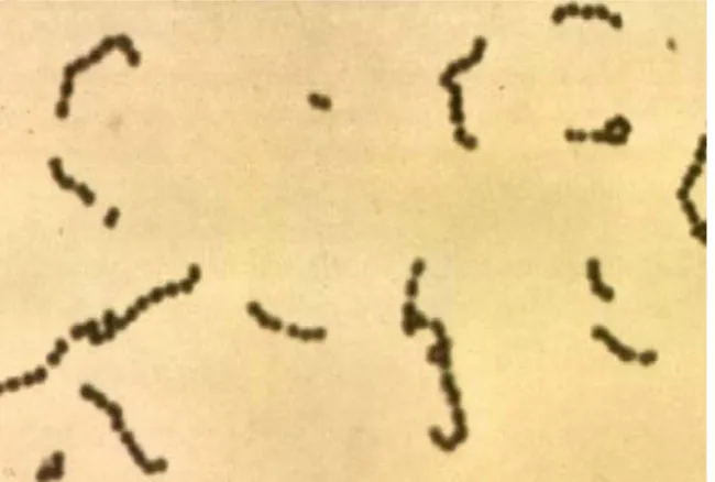 Gambar mikroskopik bakteri Streptococcus terpapar pada Gambar 2 di  bawah ini. 