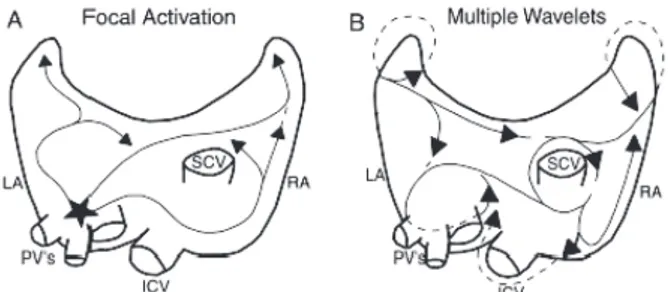 Gambar 9. Gambaran EKG 12 lead atrial fibrilasi dengan respon normal ventrikel