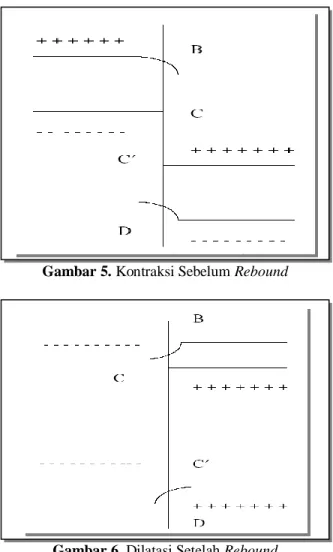 Gambar 6. Dilatasi Setelah Rebound 