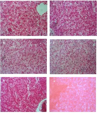 Gambar  2  Preparat histologi hati ikan bawal air tawar awal penelitan dan  setelah  