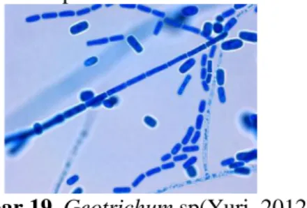Gambar 18. Kapang dari sampel TS 2.2 