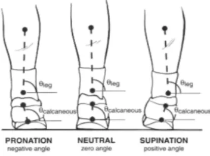 Gambar 2.13 kontribusi alignment memberi distribusi beban di permukaan  sendi lutut (Hunter, et al, 2009)  