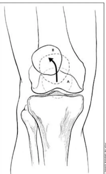 Gambar 2.4 Gambaran anatomi Patellofemoral Pain Syndrom  Sumber : www.gla.ac.uk/t4/~fbls/files/fab/images/biomech/akpqangle.gif
