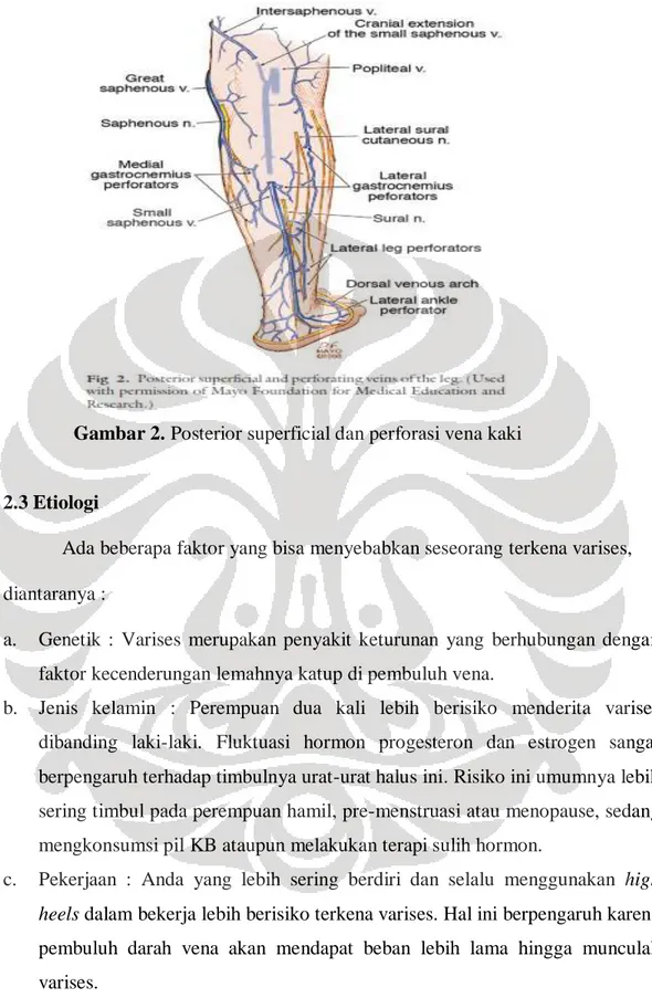 Gambar 2. Posterior superficial dan perforasi vena kaki 