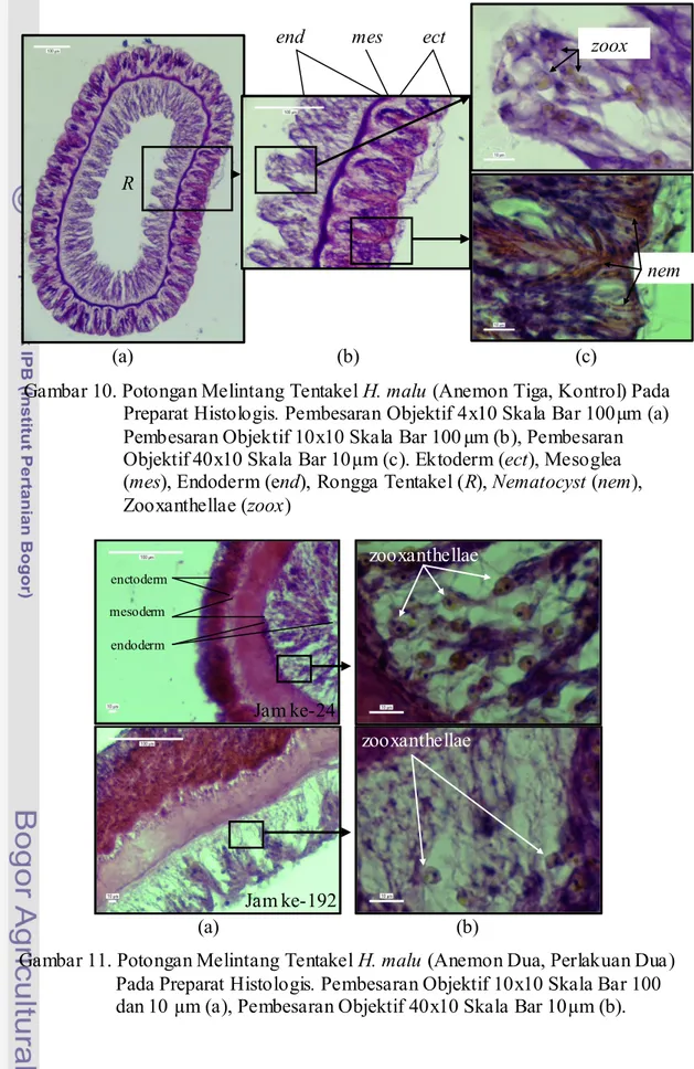 Gambar 10. Potongan Melintang Tentakel H. malu (Anemon Tiga, Kontrol) Pada  Preparat Histologis