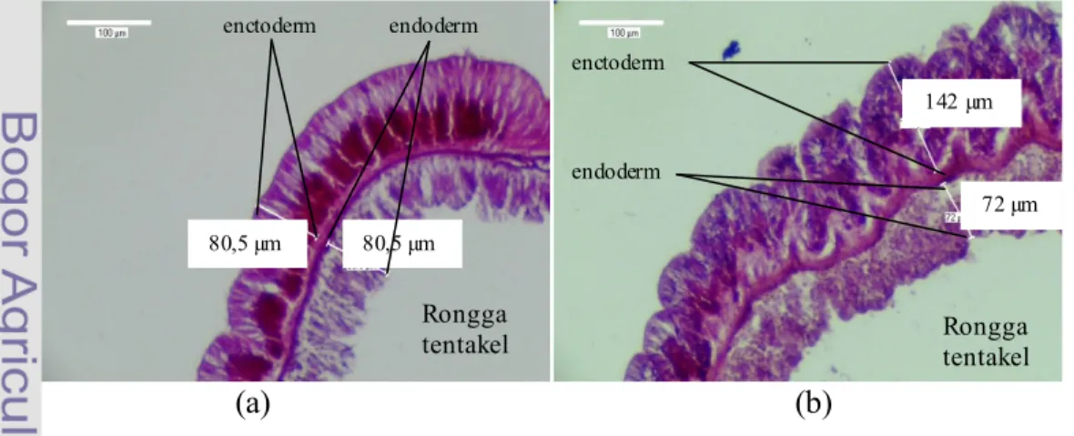 Gambar 15 memperlihatkan contoh terjadinya perubahan ketebalan lapisan  endoderm dan ektoderm pada tentakel anemon pasir (anemon dua pada   perlakuan satu)