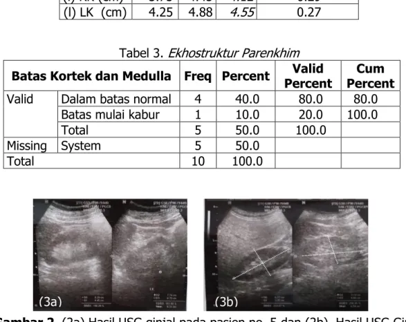 Tabel 1. Data Kretainin dan Urium dari pasien Laki-laki dan Perempuan  Parameter  Min  Max  Mean  Standar Deviasi 