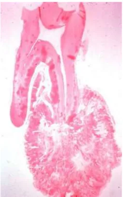 Gambar 5. A) Sementum dengan Garis Basofilik Terbalik dan Intervensi Stroma Jaringan  Ikat Longgar Fibrovaskular, B) Sementum dengan Putaran Sementoblastik Menonjol