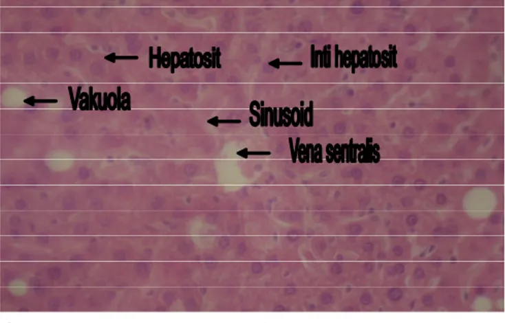 Gambar 5. Penampang melintang hepar R. tanezumi  infektif Leptospira spp. Tampak degenerasi  melemak/vakuolisasi  pada  sebagian  sel  hati