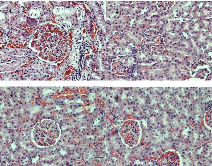 Gambar  1.  Gambar  histopatologi  ginjal  tikus  putih  perlakuan  P0.  Terlihat  adanya  penutupan  lumen  tubulus  proksimal  dan  nekrosis  epitel  (HE,  400x)