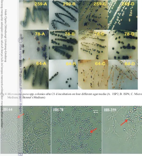 Fig 4 Micromonospora spp. colonies after 21 d incubation on four different agar media (A