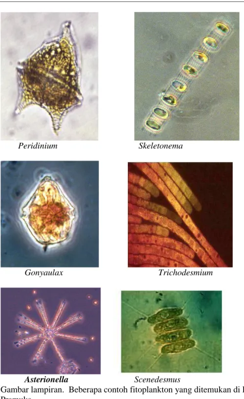 Gambar lampiran.  Beberapa contoh fitoplankton yang ditemukan di Pulau  Pramuka 