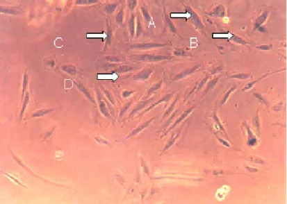 Gambar 1. Morfologi Sel Endotel Vena Umbilikalis Manusia Primer Normal Hari Ke-4 kultur, diambil dengan Mikroskop Inverted