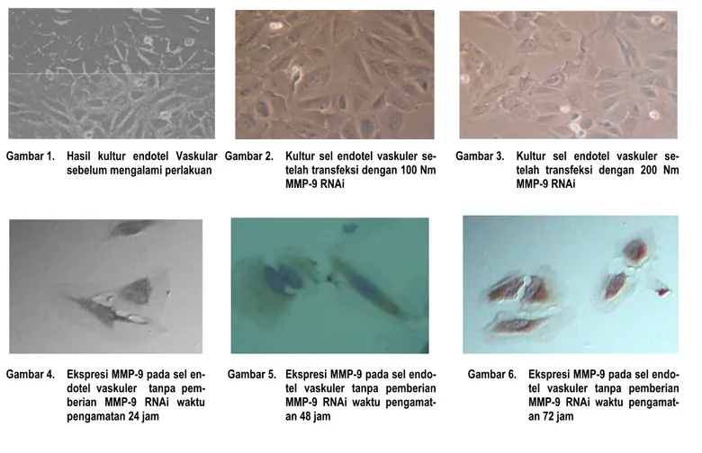 Gambar 3.   Kultur  sel  endotel  vaskuler  se- se-telah  transfeksi  dengan  200  Nm  MMP-9 RNAi 