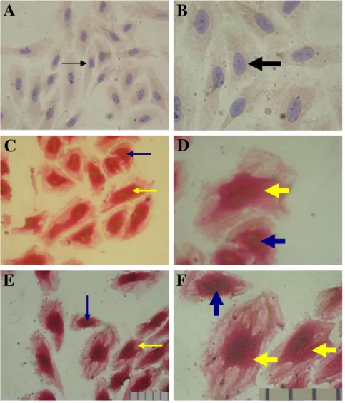Gambar 1. Kultur  HUVEC’s  yang  dipulas  dengan  metode  immunodoublestaining  menggunakan  dua   antibodi, mouse monoclonal anti NFkB dan mouse monoclonal anti PPARγγγγ yang menggunakan  substrat  DAB  (warna  coklat)  untuk  NFkB  dan  Fast  Red  (warna