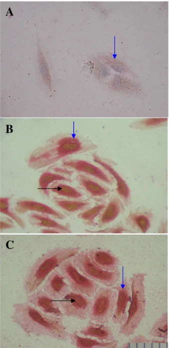 Gambar  2.Kultur  HUVEC’s  yang  dipulas  dengan  metode  doublestaining  DNA  terfragmentasi  (TUNEL)  dan  ekspresi  TNFα  (imunositokimia)  yang  menggunakan  substrat  DAB  (warna  coklat)  untuk  DNA  terfragmentasi  dan  Fast  Red  (warna  merah)  un