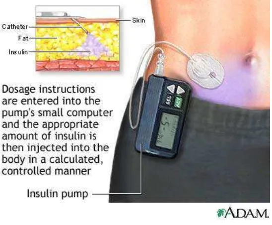 Gambar Sediaan Insulin Vial 