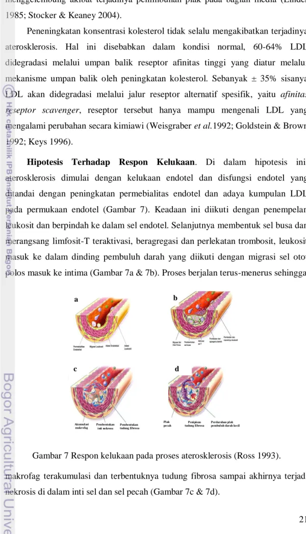 Gambar 7 Respon kelukaan pada proses aterosklerosis (Ross 1993).