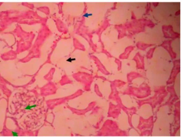Gambar  8.  Fotomikrograf  histopatologi  ginjal  babi  pada  perlakuan  7,5%.  Pada  tubulus  proksimal,  tubulus  distal  dan  glomerulus  ditemukan  adanya  degenerasi  melemak  ( ),  nekrosis  ( )  dan  inflamasi ( )