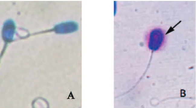 Tabel 1. Status Kerusakan DNA spermatozoa domba sebelum dan setelah kriopreservasi                      Status DNA (%)