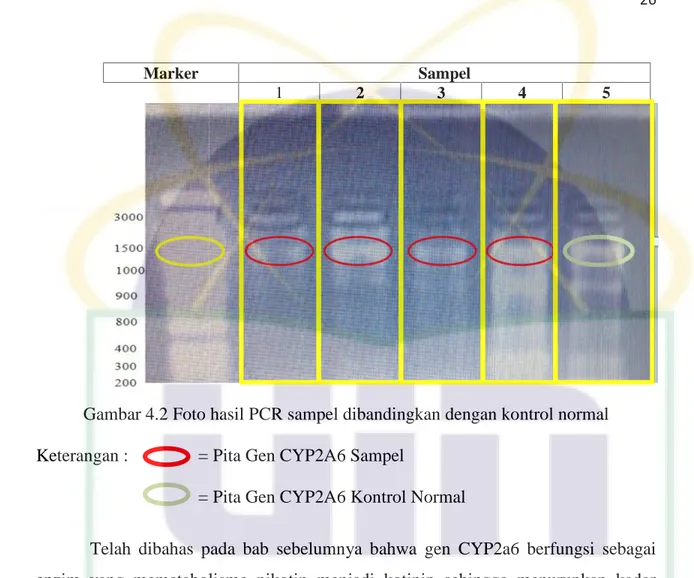 Gambar 4.2 Foto hasil PCR sampel dibandingkan dengan kontrol normal Keterangan : = Pita Gen CYP2A6 Sampel