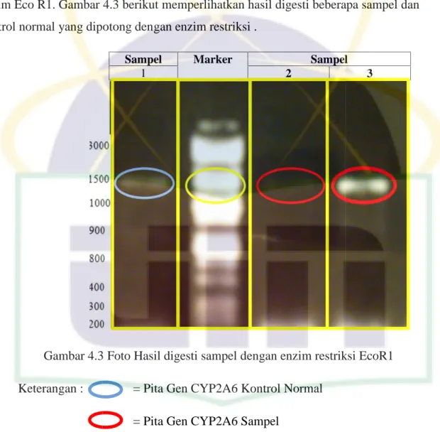 Gambar 4.3 Foto Hasil digesti sampel dengan enzim restriksi EcoR1 Keterangan : = Pita Gen CYP2A6 Kontrol Normal