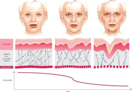 Gambar 2.2 Ilustrasi kulit wajah kekurangan kolagen  Sumber : Epilightnewskin (2015)  