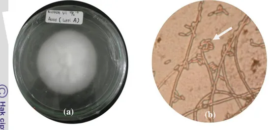 Gambar 2  Koloni Lecanicillium lecanii di media PDA (a) dan konidia L. lecanii  yang diproduksi oleh setiap tangkai konidiofor, perbesaran 400x (b)