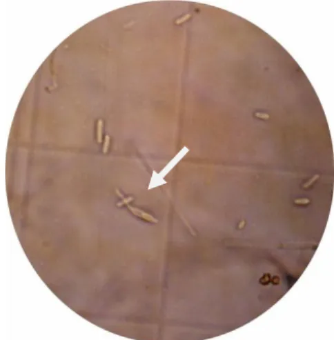 Gambar 6  Tabung kecambah L. lecanii pada 10 jam setelah inkubasi (JSI). 