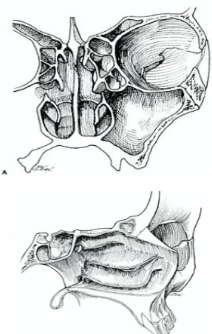 Gambar 2. Ohngren line. 5 