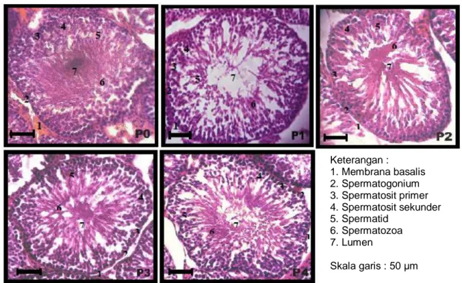 Gambar  1.    Struktur  mikroanatomi  tubulus  seminiferus  testis  tikus  jantan  yang  dipapar  asap  rokok  setelah pemberian ekstrak etanol bulbus bawang dayak sebagai antioksidan selama 53  hari
