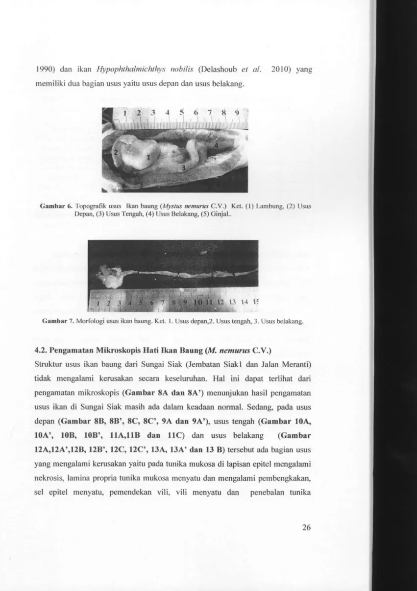 Gambar 6. Topografik usus Ikan baung {Mystus nemurus C.V.) Ket. (1) Lambung, (2) Usus  Depan, (3) Usus Tengah, (4) Usus Belakang, (5) Ginjal.
