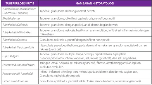 Tabel 2 Gambaran Histopatologi Tuberkulosis Kutis