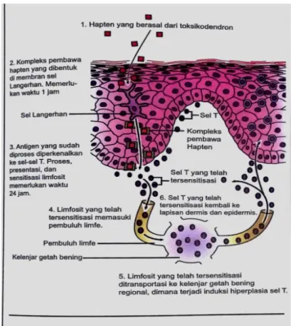 Gambar 2.1 Mekanisme terjadinya dermatitis kontak 