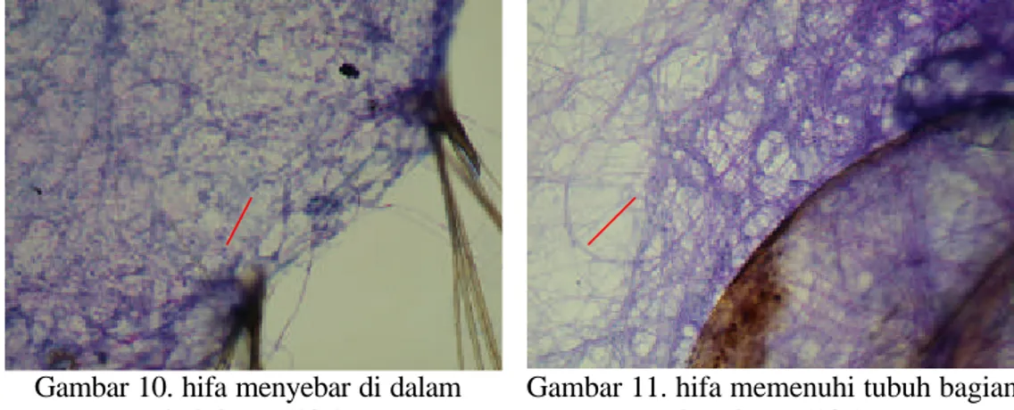 Gambar 11. hifa memenuhi tubuh bagian  luar larva (10x) 