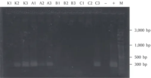 Gambar 4A juga menunjukkan bahwa pada bebe- bebe-rapa sampel ekspresi tertinggi terdapat pada limpa yang ditunjukkan dengan lebih tebalnya fragmen yang dihasilkan dibanding pada ginjal