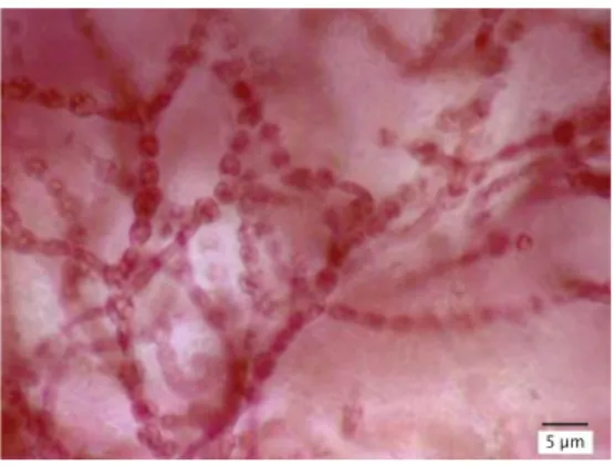 Figure 3. Comparison of K. alvarezii callus: (a) embryogenic callus;