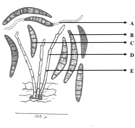 Gambar 1. Konidia Helminthosporium maydis Nisik.                     